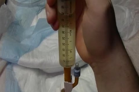 I put in A 24 French Catheter In Me. I Take In 500 ML Of Water In My Bladder. whilst My Bladder Is To The Bursting Point Play With Myself To The Point I cum whilst Having A Full Bladder. At The End I Drain My Bladder Then Remove The Catheter.